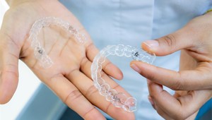 Invisalign: ¿Es realmente efectivo?