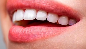 Odontología estética: ¿qué posibilidades tenemos?