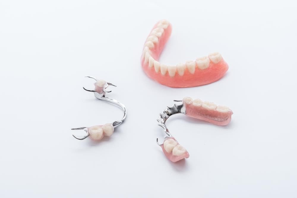 ¿Qué tipos de prótesis dentales hay? ¿Cuál es su mantenimiento?