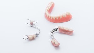 ¿Qué tipos de prótesis dentales hay? ¿Cuál es su mantenimiento?